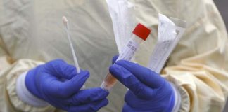 Covid Marche, nelle ultime 24 ore 357 positivi su 1229 tamponi di nuove diagnosi