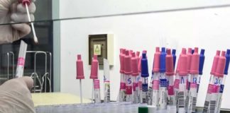 Coronavirus Marche, dati Gores: 137 positivi su 572 tamponi effettuati