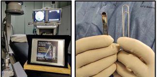 Ospedale di Ascoli, impiantato un nuovo rivoluzionario monitor cardiaco miniaturizzato